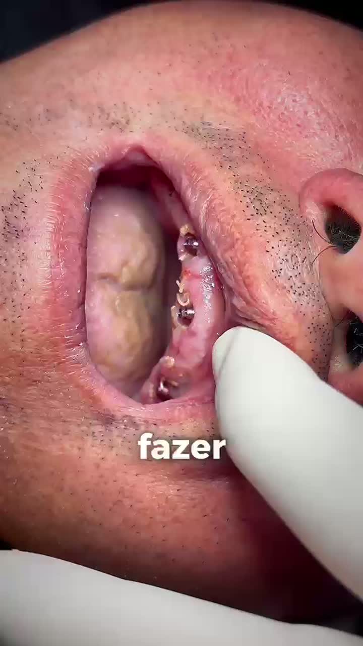 Depoimento de Paciente Complexo MA